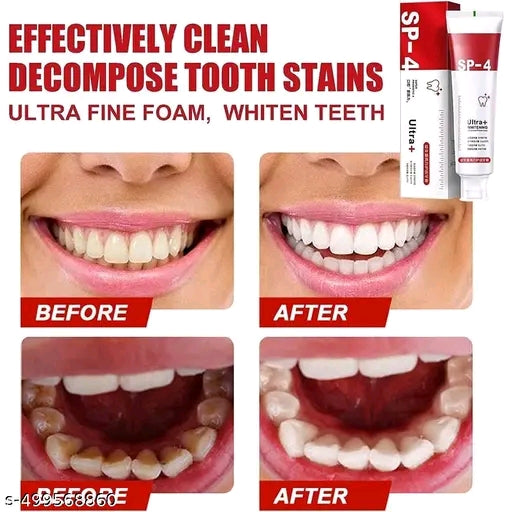 SP-4 Probiotic Whitening Toothpaste, Teeth Whitening Toothpaste (Pack of 2)